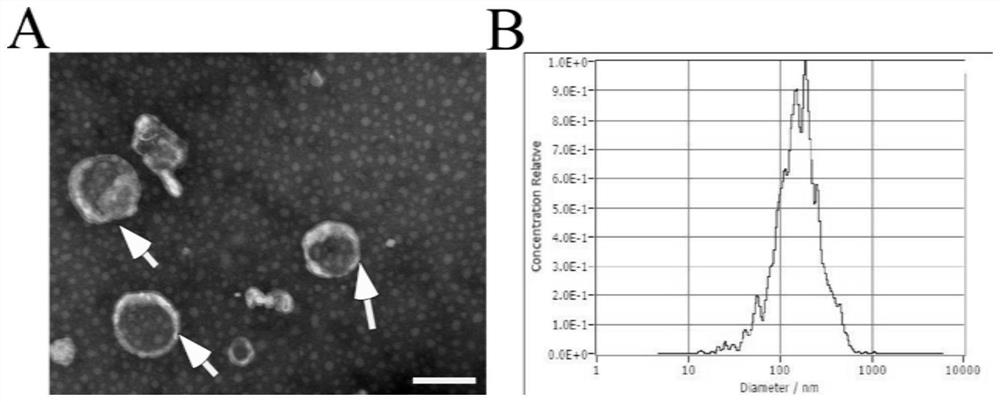 Application of tea exosome in preparation of medicine for protecting intestinal barrier and treating irritable bowel syndrome