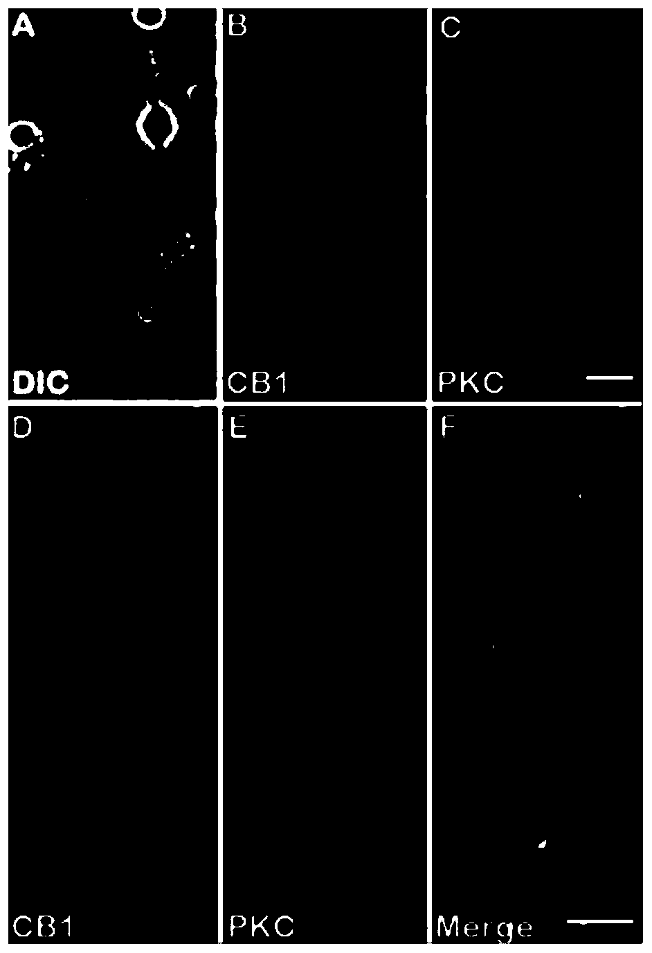 Application of cannabinoid receptor CB1 in retinal photoreceptor cell degenerative diseases