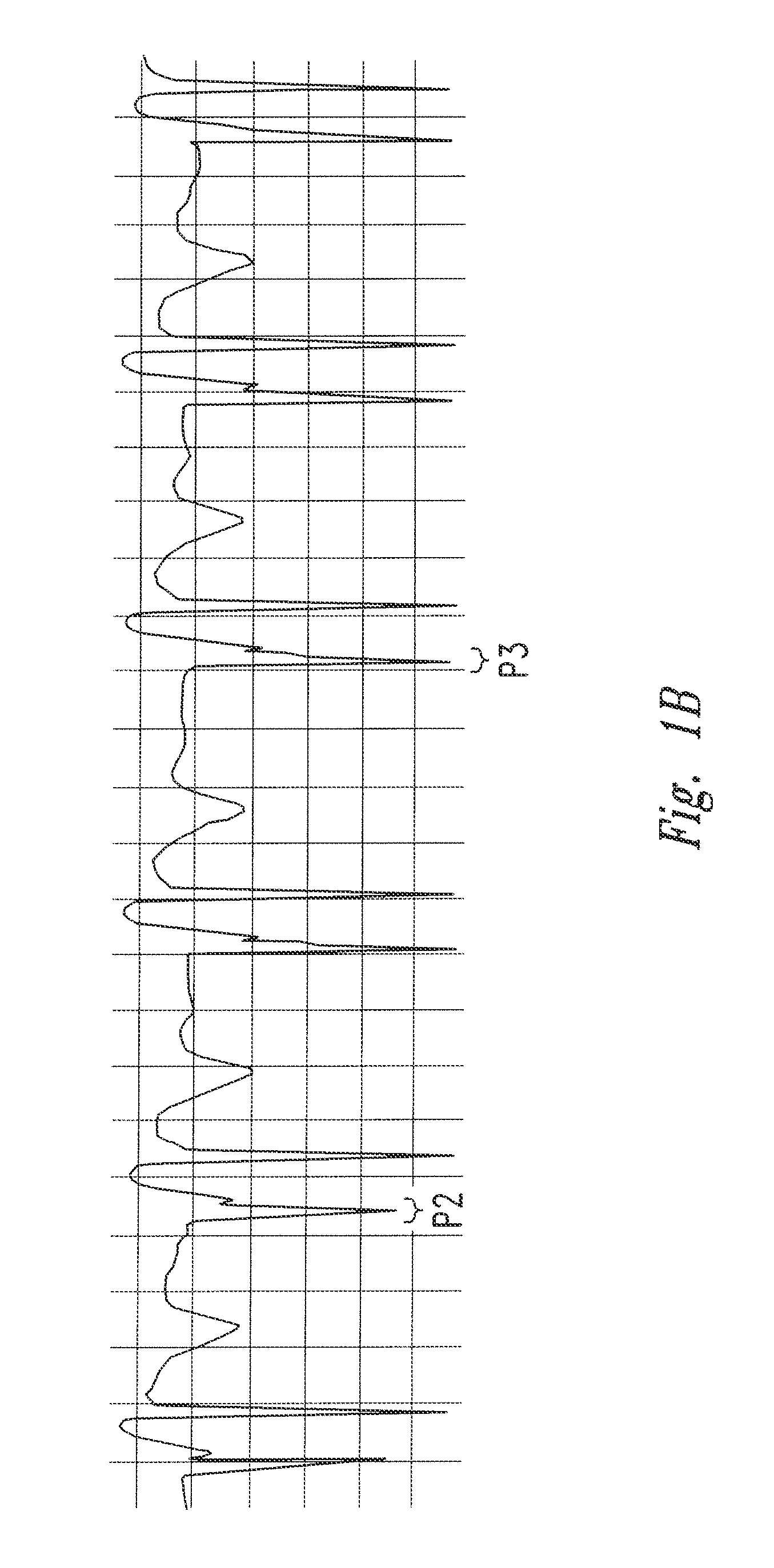 Method of locating the tip of a central venous catheter