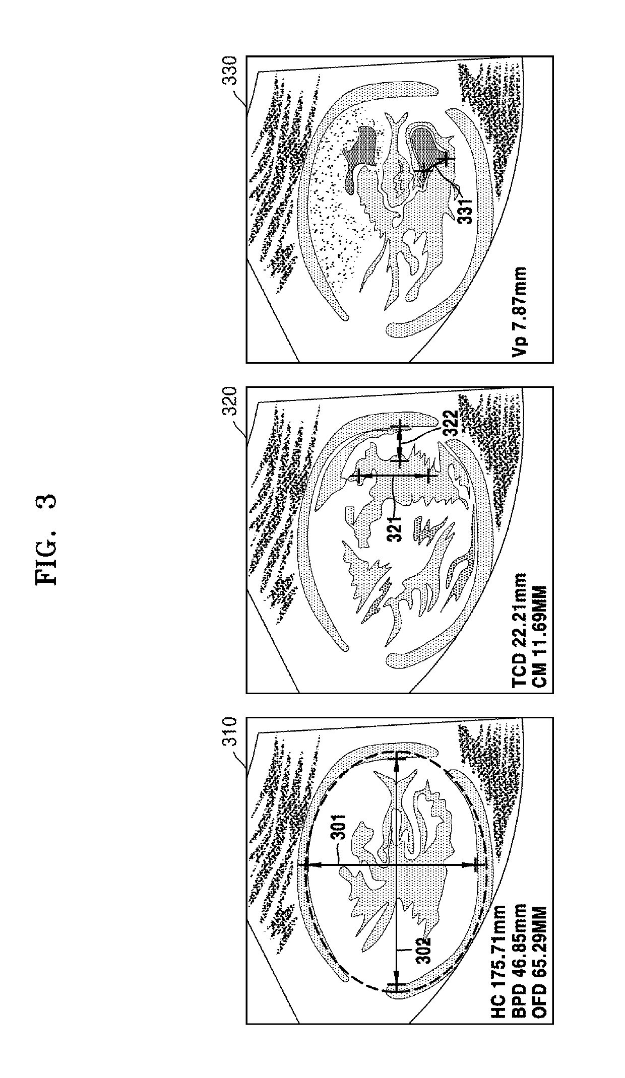 Ultrasound diagnosis apparatus and method for generating image from volume data and displaying the same