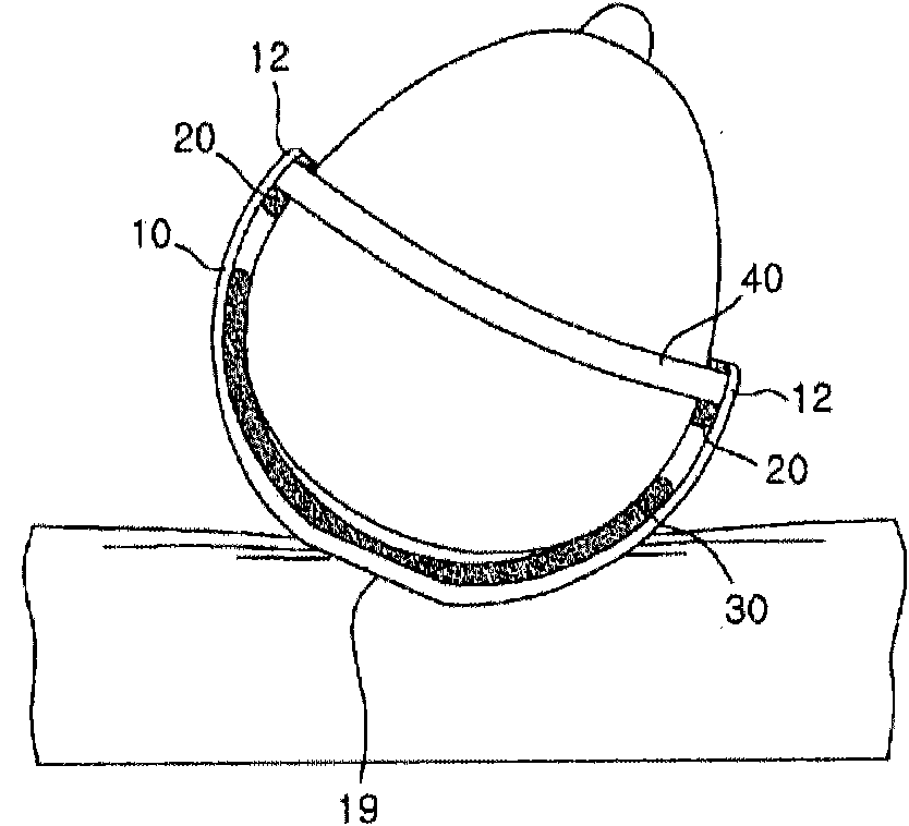 Head-shape remodelling instrument