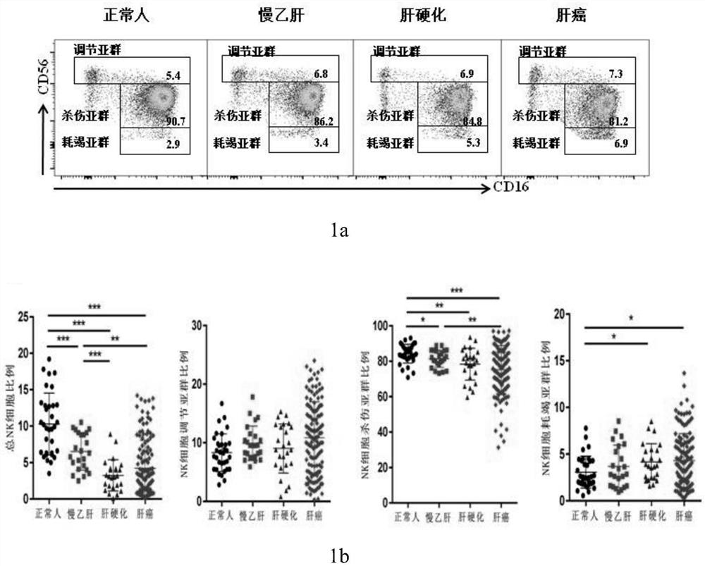 System for determining prognosis of hepatitis B related liver cancer by using TIGIT and TIM-3 on NK cell