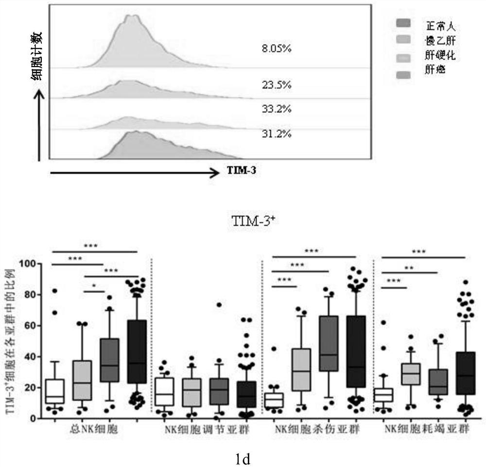 System for determining prognosis of hepatitis B related liver cancer by using TIGIT and TIM-3 on NK cell
