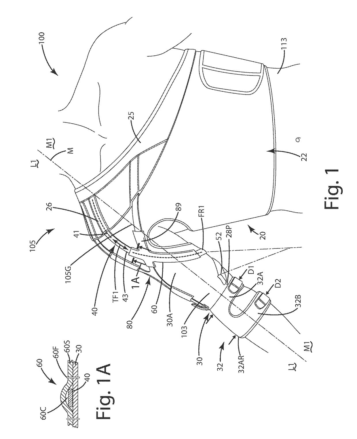 Dynamic tensioning orthosis and related method of use