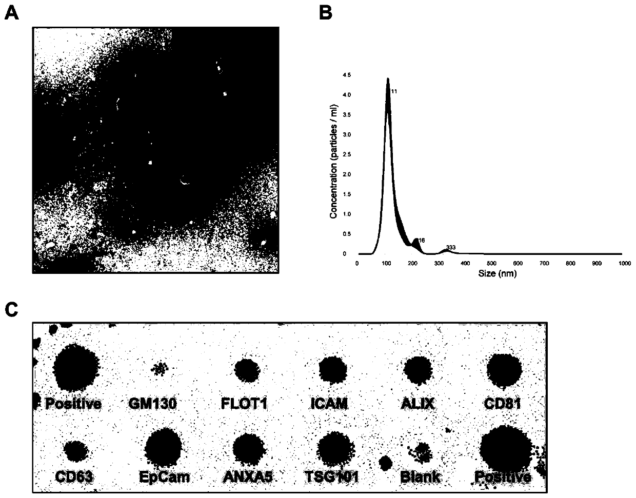 Screening method for serum exosome marker of laryngeal squamous carcinoma and application for exosome source miR-941