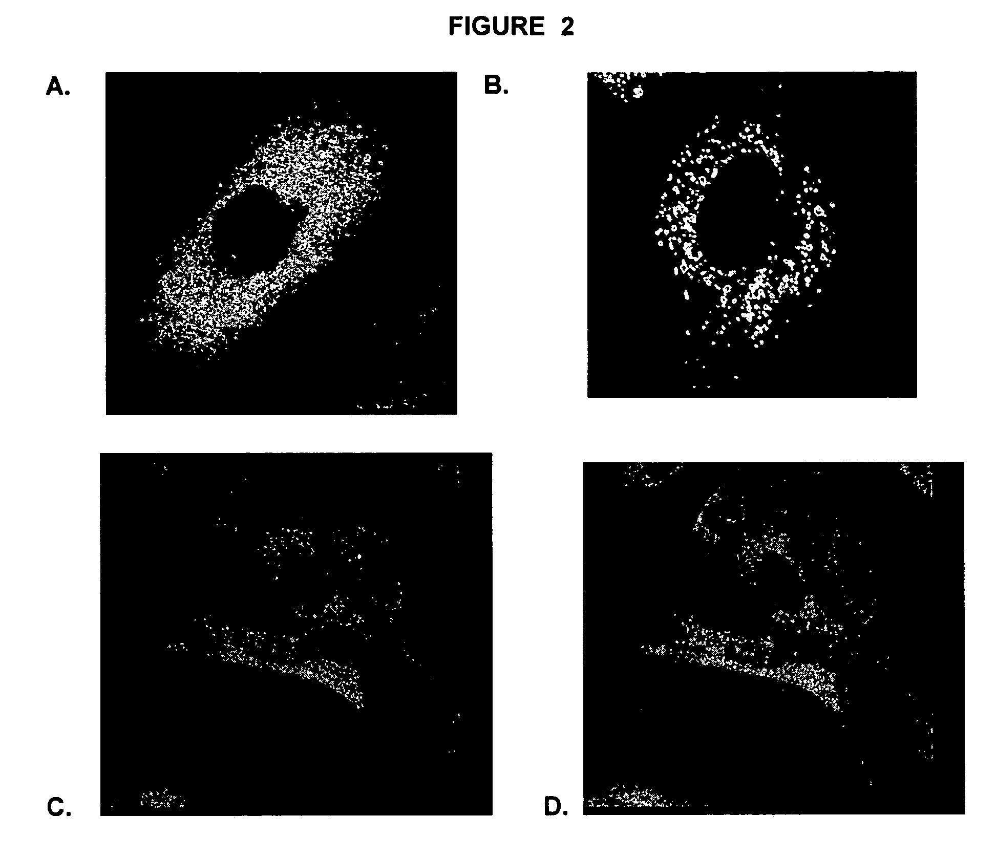 Methods for treating parkinsons disease and parkinsonism