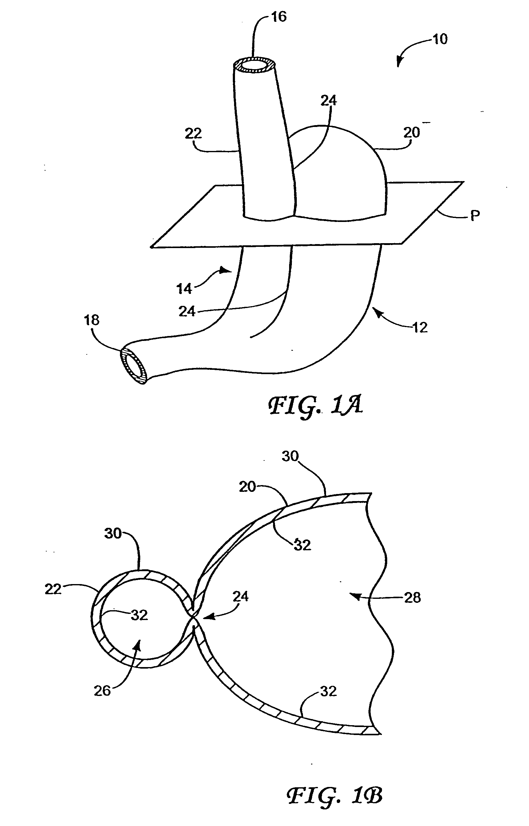 Obesity treatment tools and methods