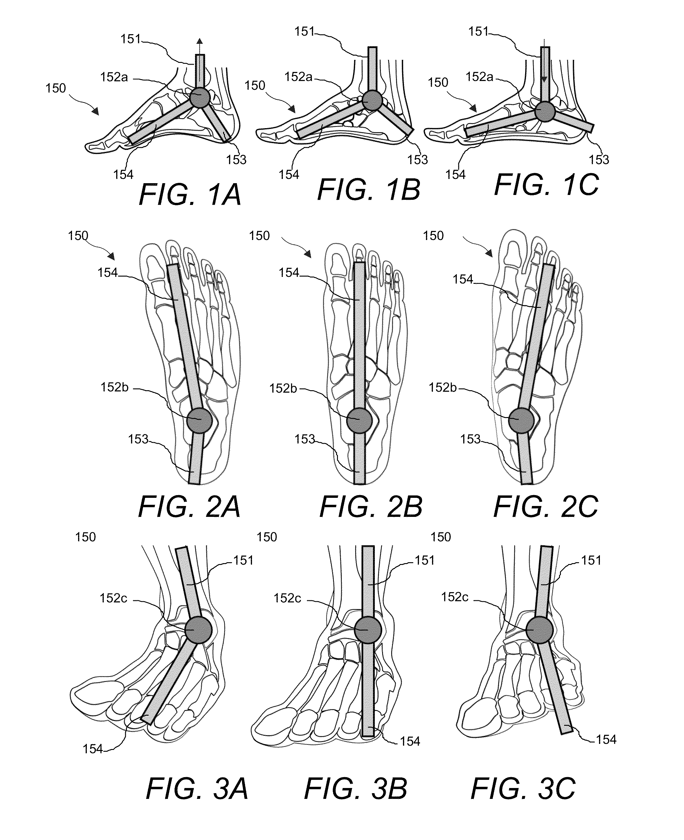 Article of footwear with embedded orthotic devices