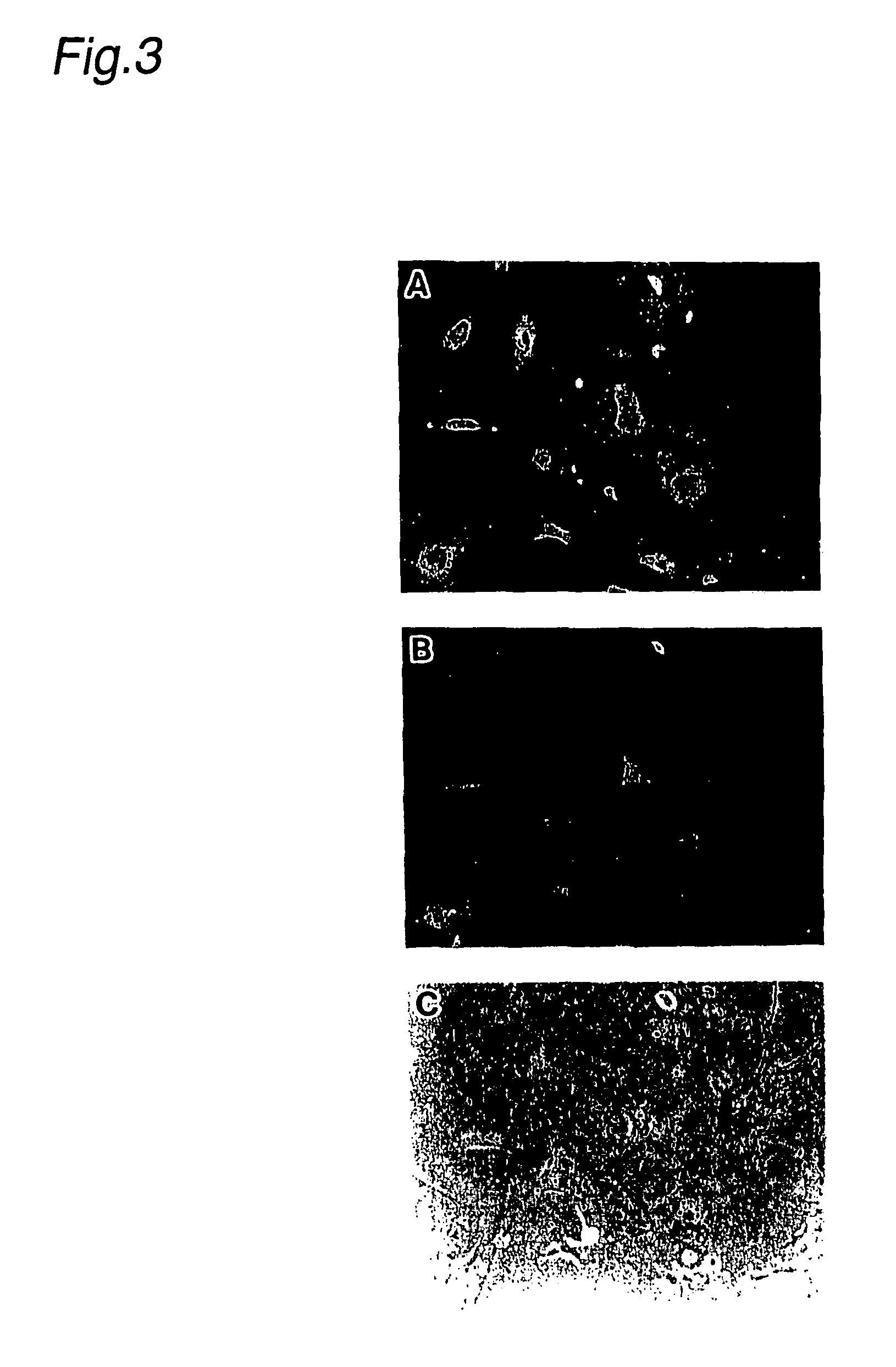 Pharmaceutical for prevention and treatment of demyelinating disease