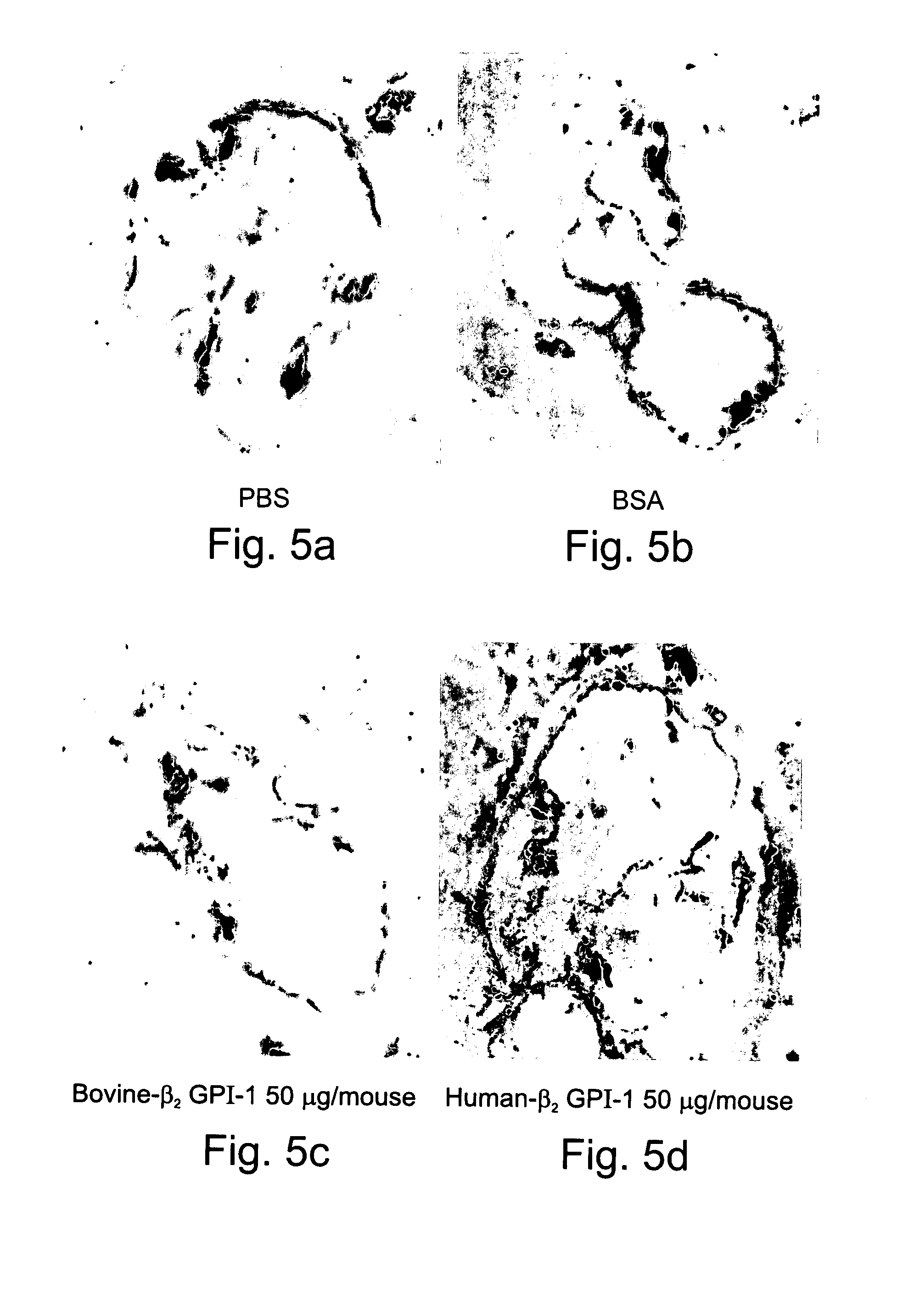 Compositions Containing Beta 2-Glycoprotein I-Derived Peptides for the Prevention and/or Treatment of Vascular Disease
