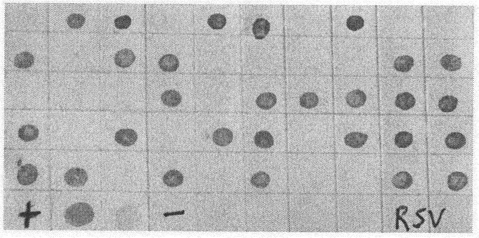 Method for improving strip virus resistance of rice by using melatonin