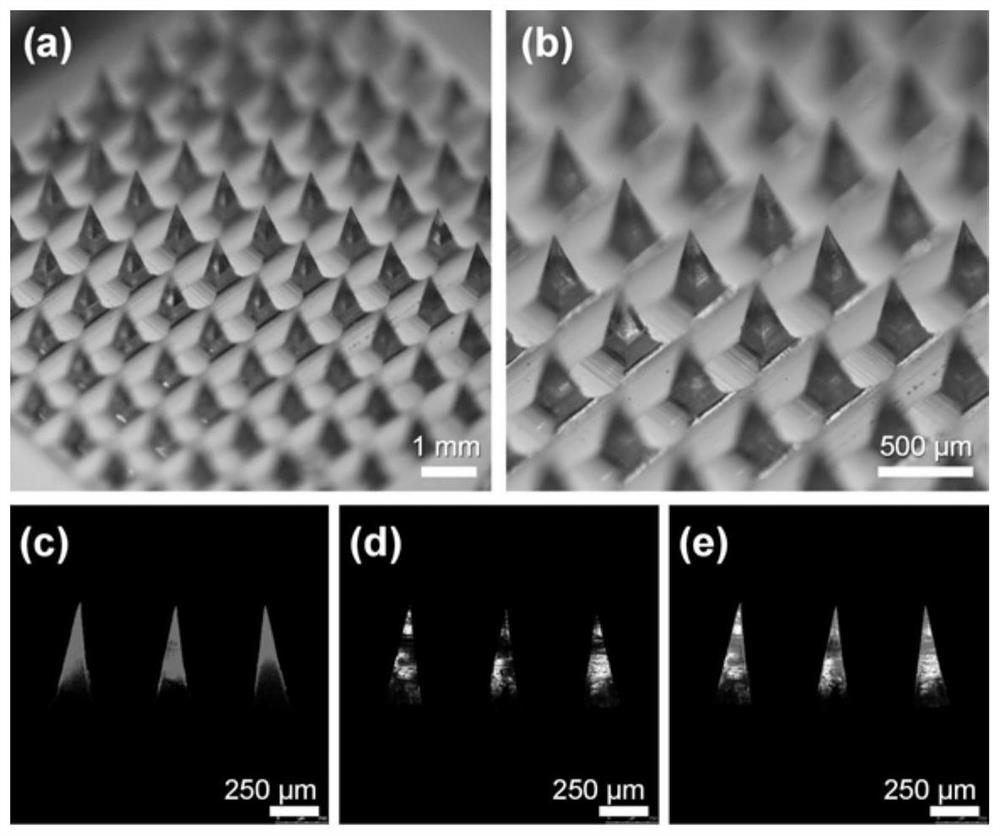 Double-drug-loaded polymer microneedle used for oral mucosa administration and preparation method of double-drug-loaded polymer microneedle