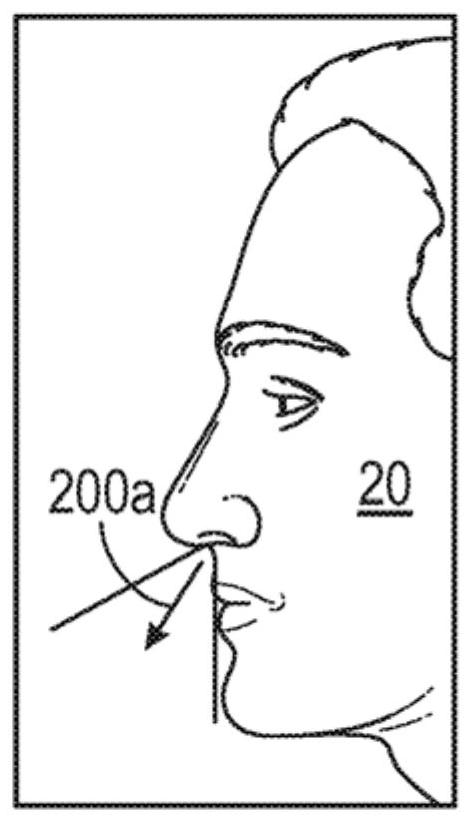 Nasal and oral respiration sensor