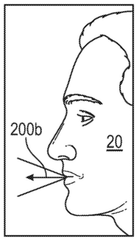 Nasal and oral respiration sensor