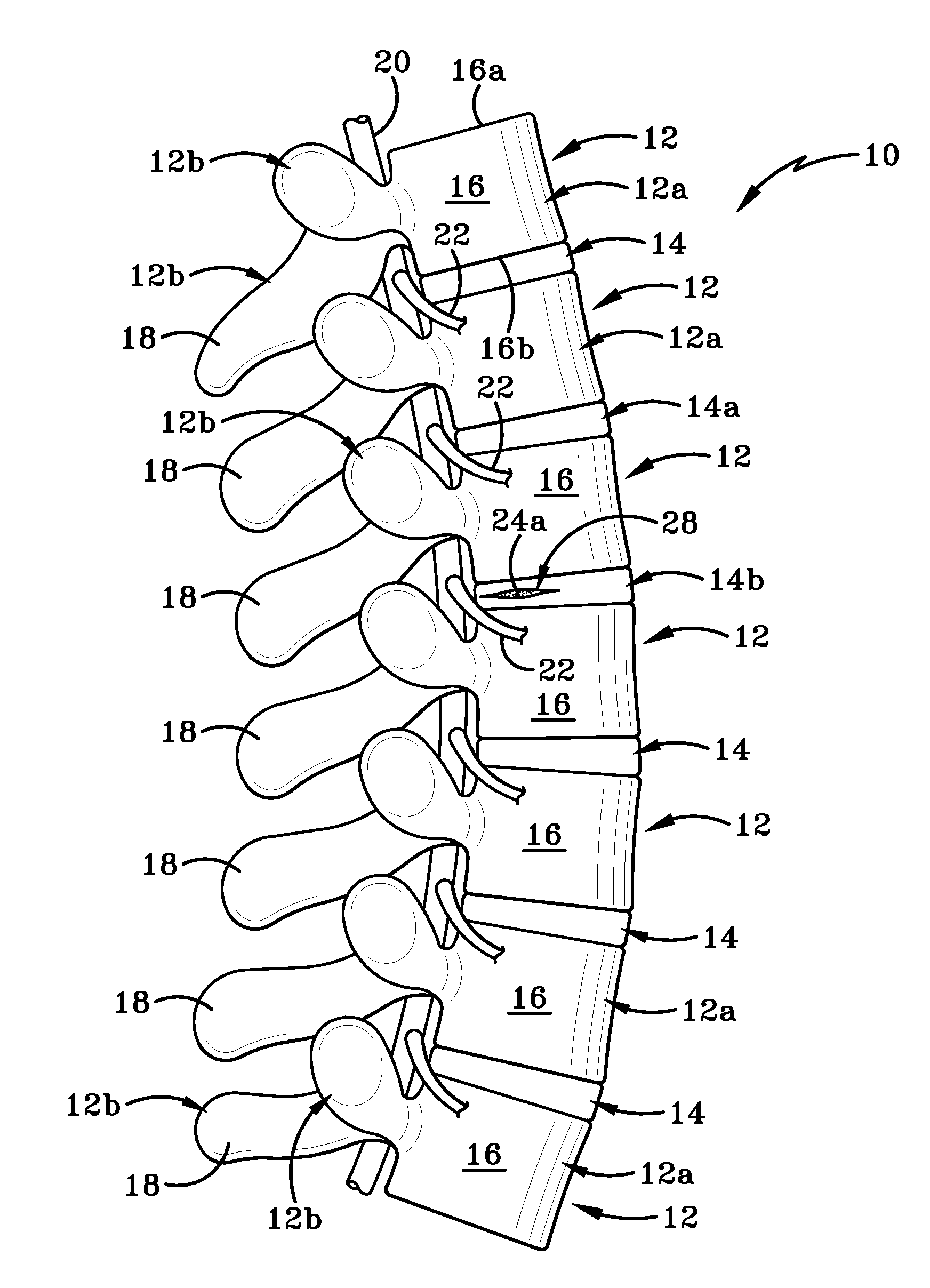 Nucleus pulposus spinal implant and method of using the same