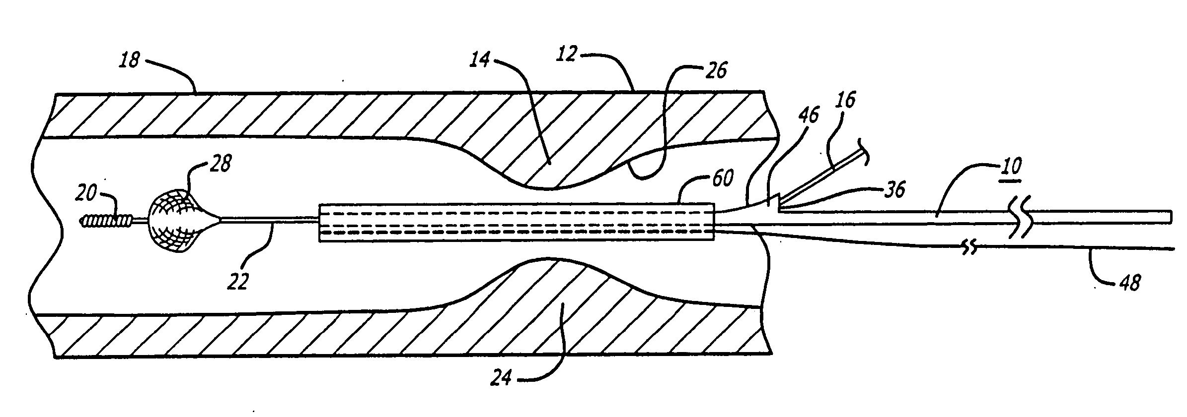 Delivery and recovery system for embolic protection system