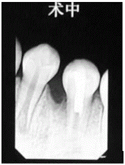 Dental pulp regeneration paste and preparing method thereof