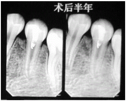 Dental pulp regeneration paste and preparing method thereof