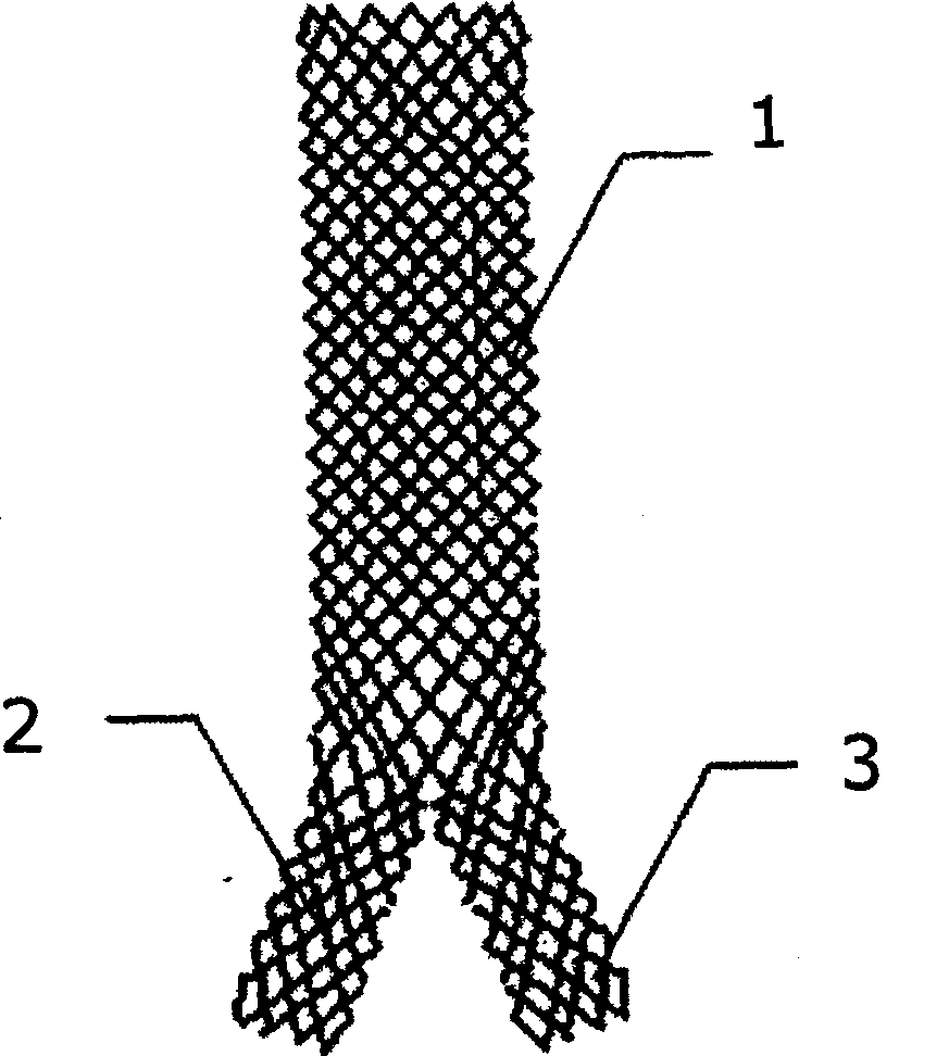 Y-shaped Ni-Ti alloyed tracheal net braided stent and its manufacture method