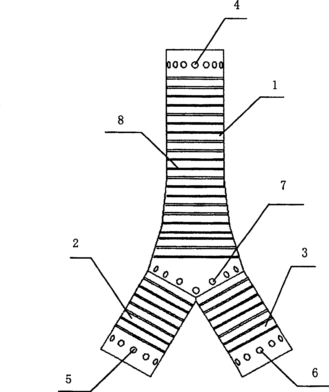 Y-shaped Ni-Ti alloyed tracheal net braided stent and its manufacture method