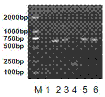 cDNA overall length nucleotide sequence of human EBLN-1 gene and cloning method thereof