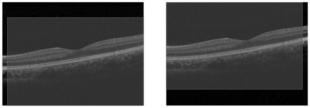A fundus oct image fusion method and device