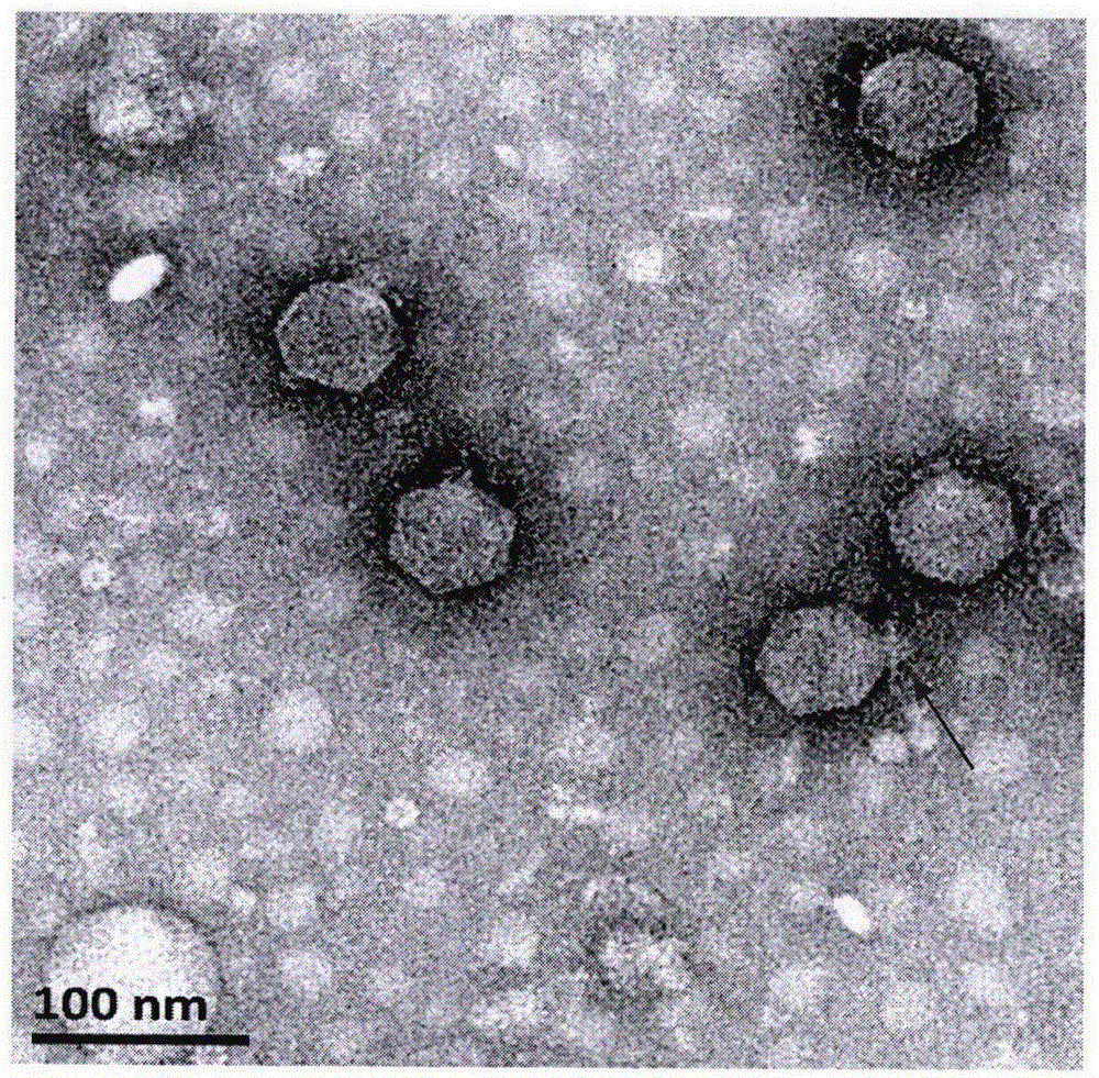 Separation and identification of a strain of novel Enterohemorrhagic Escherichia coli O157 phage PE-3 in sewage treatment system