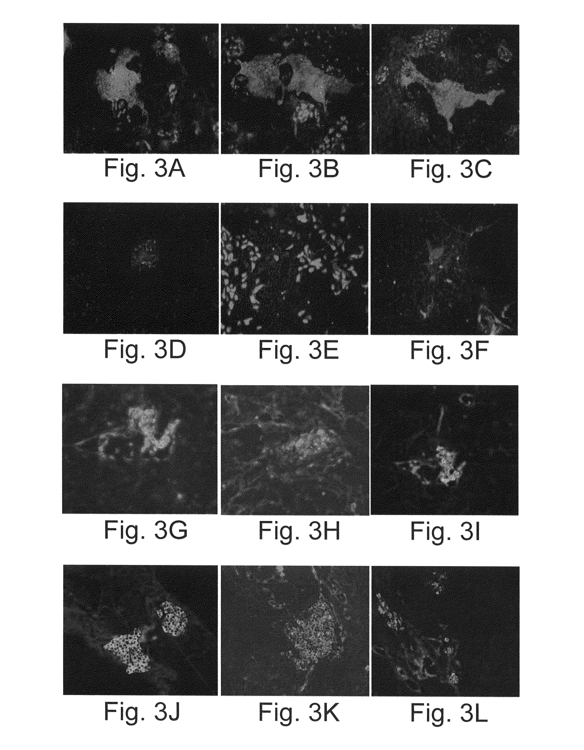 Vascularized islets and methods of producing same