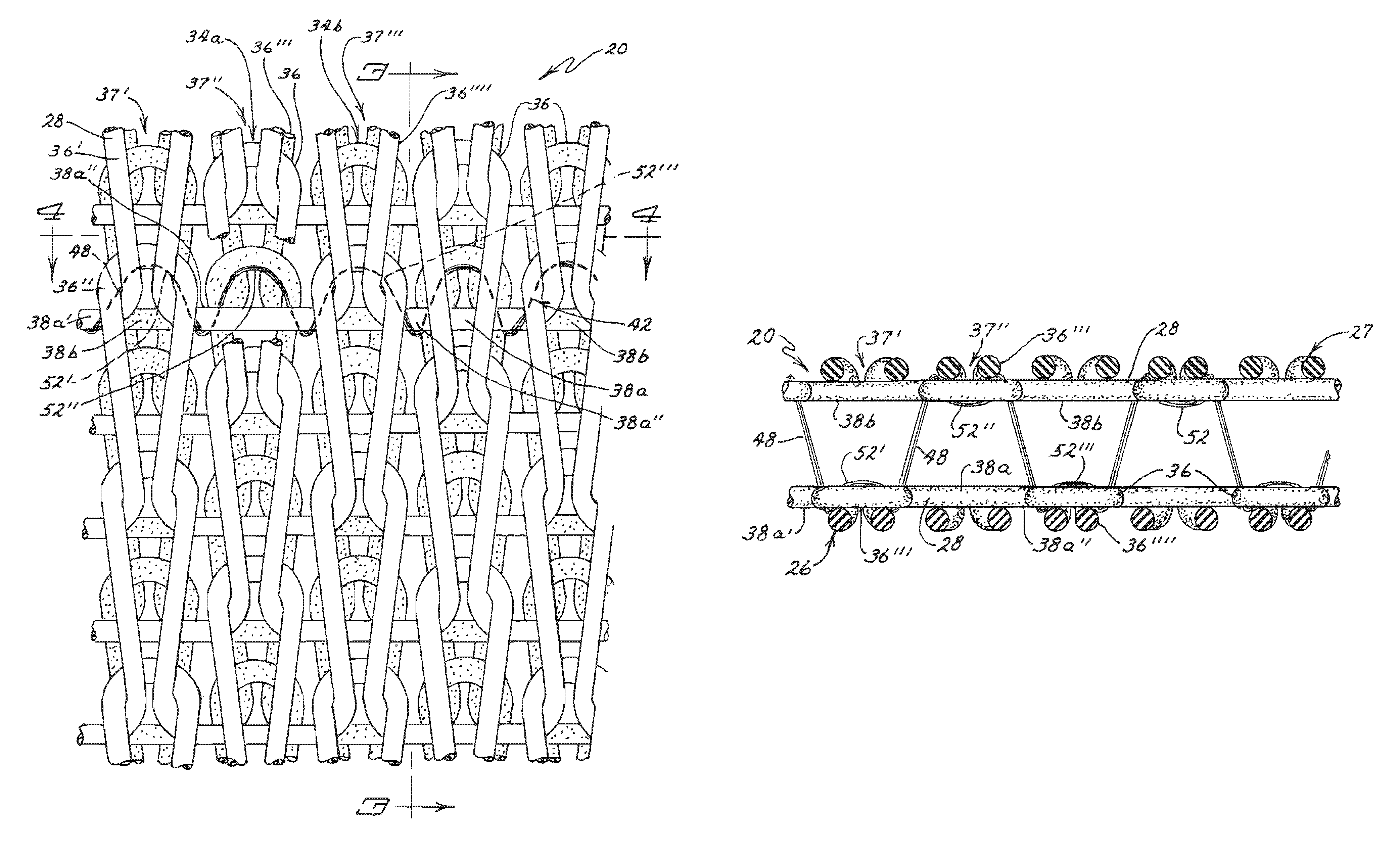 Modified jersey knit fabric and methods of making the same