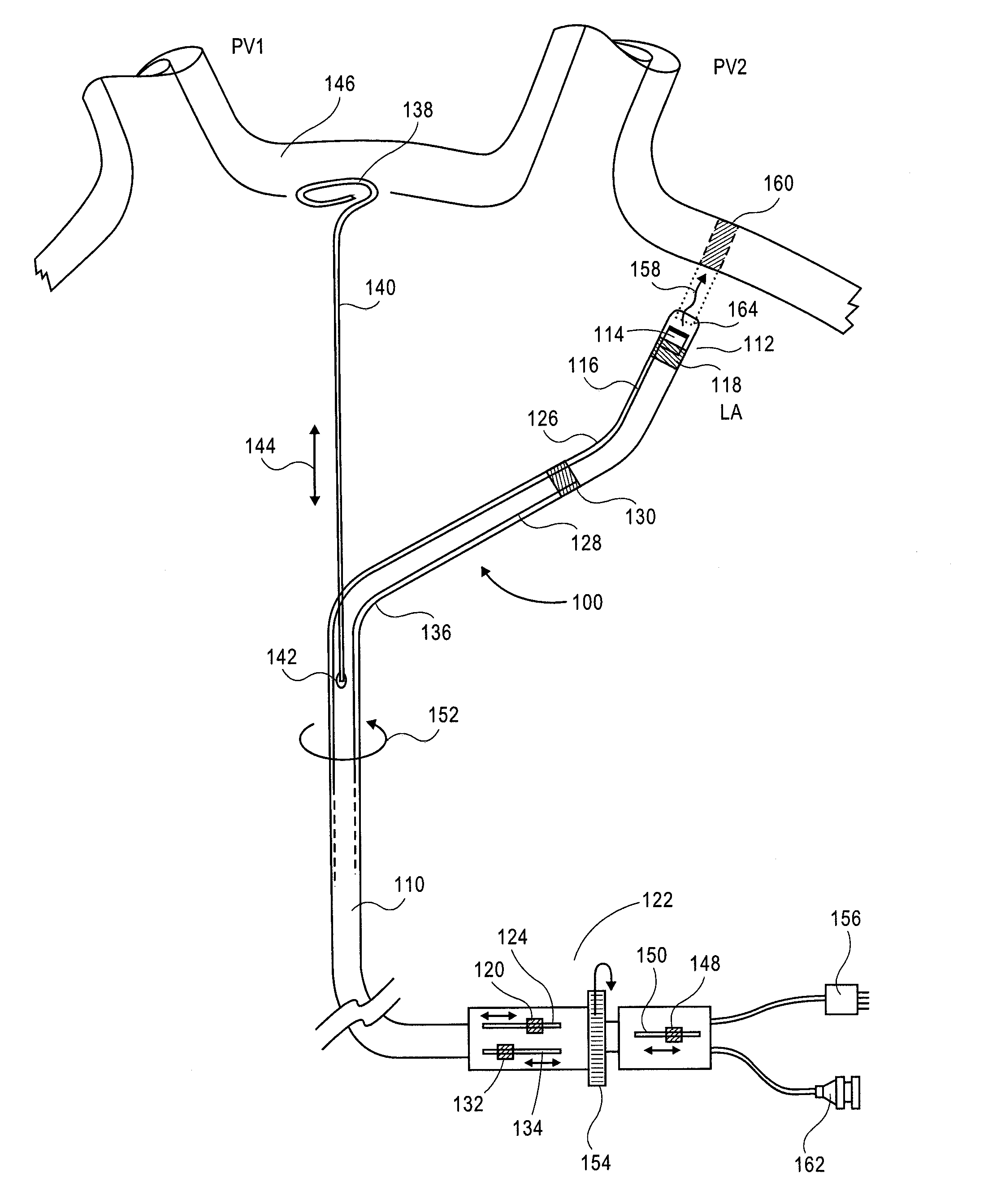 Device for Ablating Body Tissue