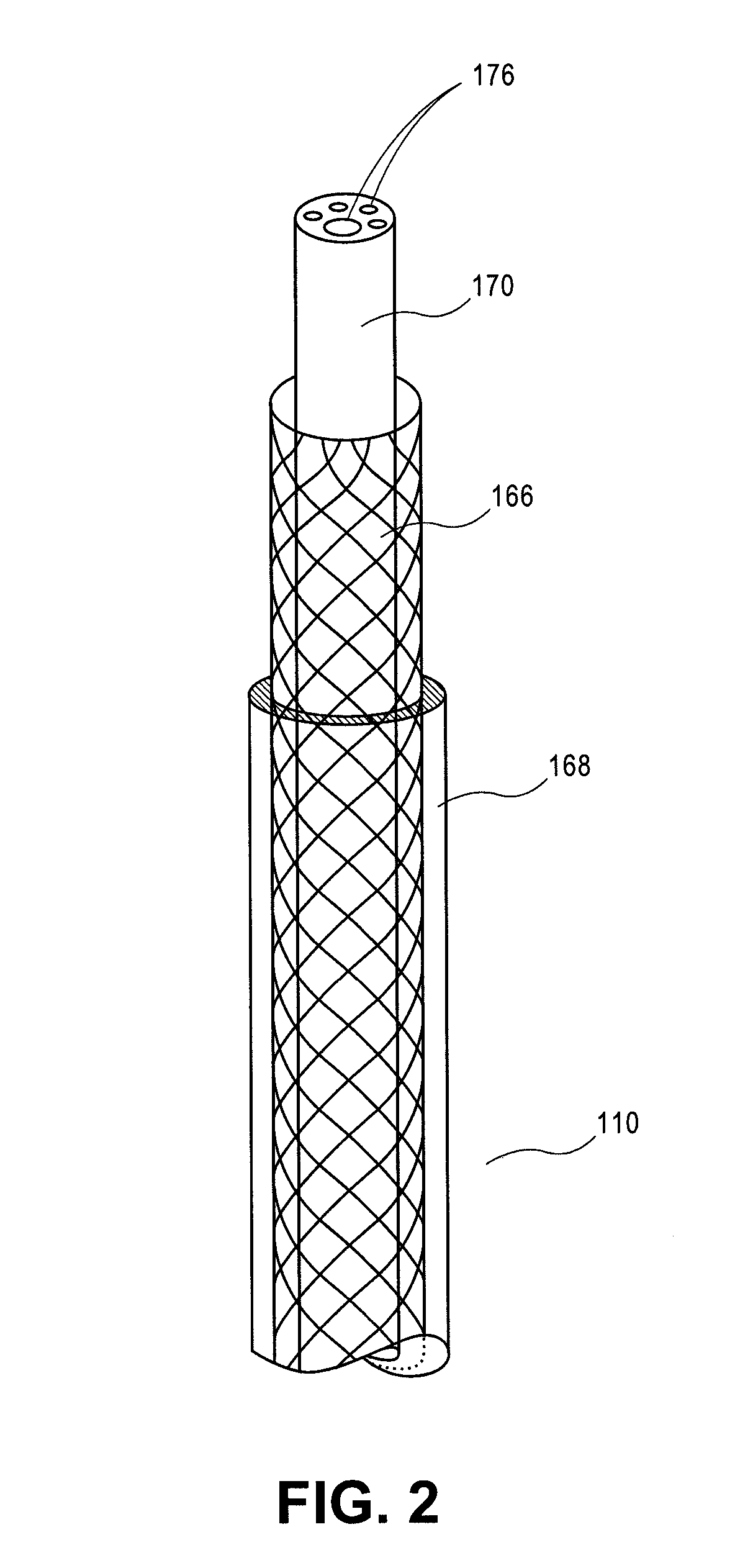Device for Ablating Body Tissue