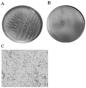 A kind of Citrobacter freundii having the ability to decompose phosphorus and potassium and its application