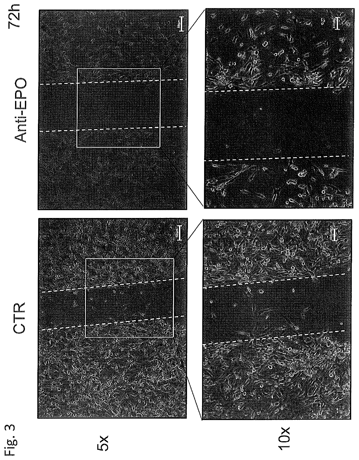 Use of negative functional modulators of erythropoietin for therapy