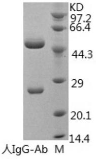 Anti-human-IgG monoclonal antibody, hybridoma cell strain capable of secreting anti-human-IgG monoclonal antibody and application of anti-human-IgG monoclonal antibody