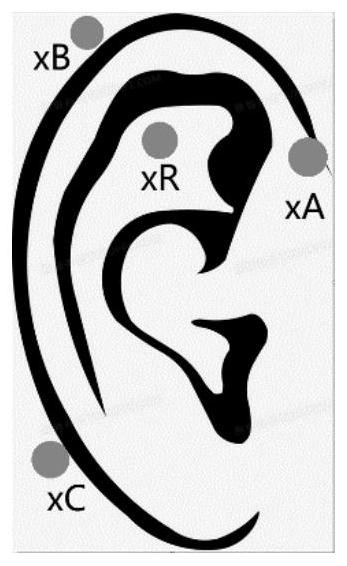 Portable sleep monitoring system based on ear EEG