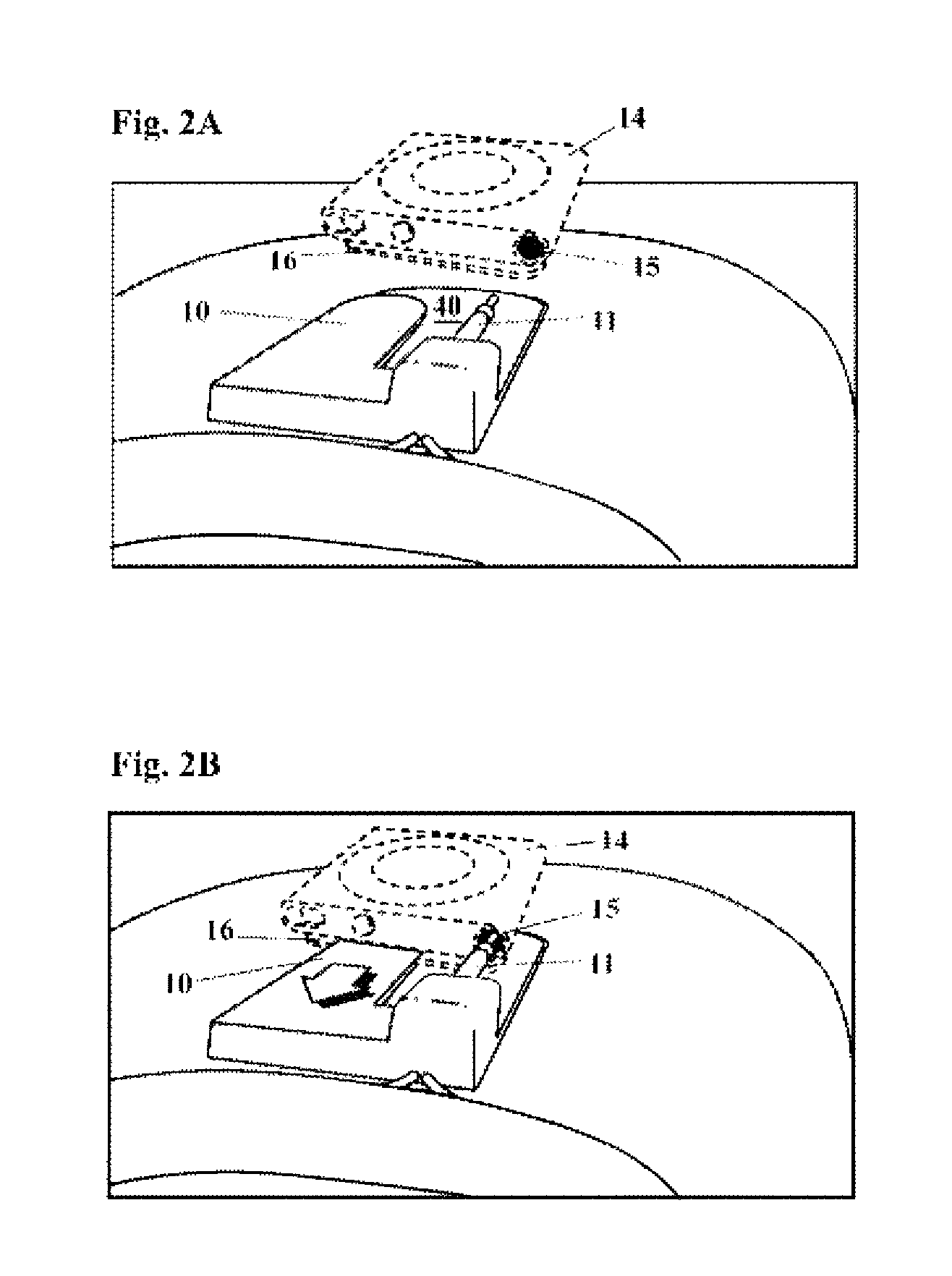 Apparatus for mounting an audio player