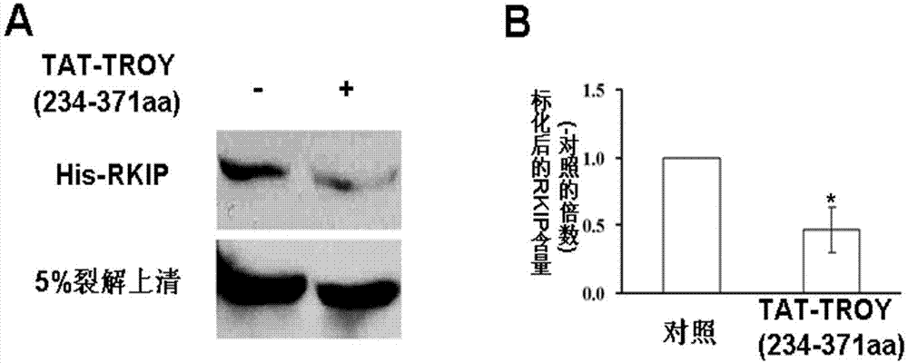 Application of polypeptide in preparation of drug for preventing and treating glioblastoma