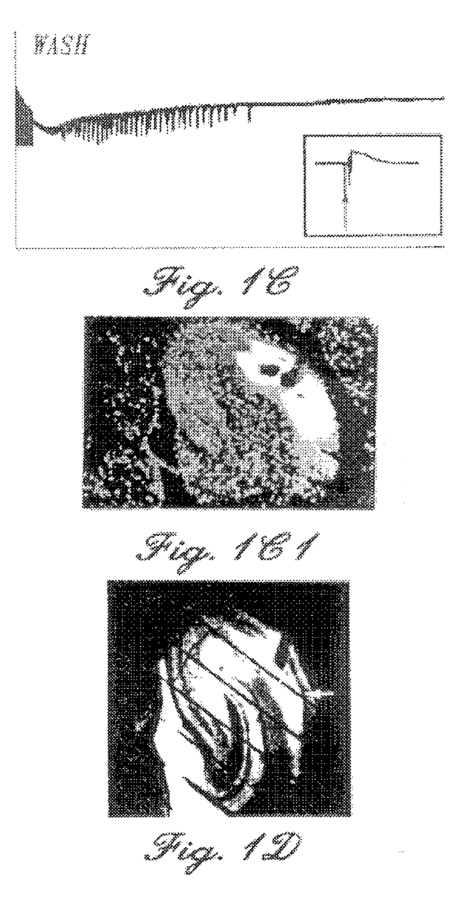 Compositions and methods for the treatment of disorders of the central and peripheral nervous systems