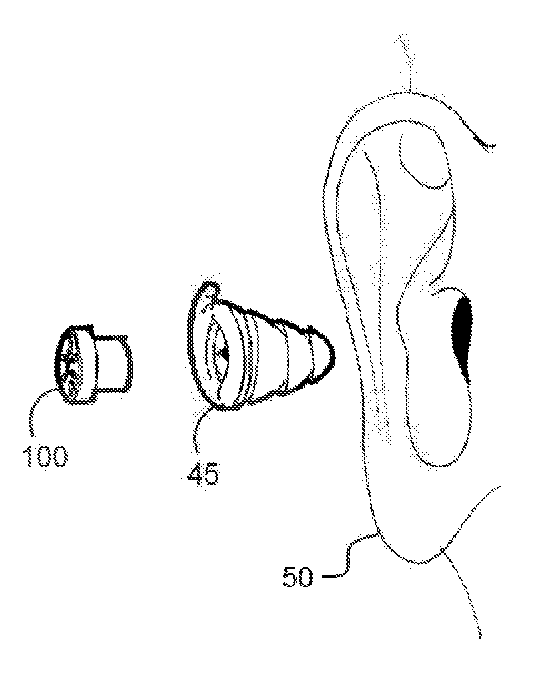 Hearing protection devices and attenuation button for same