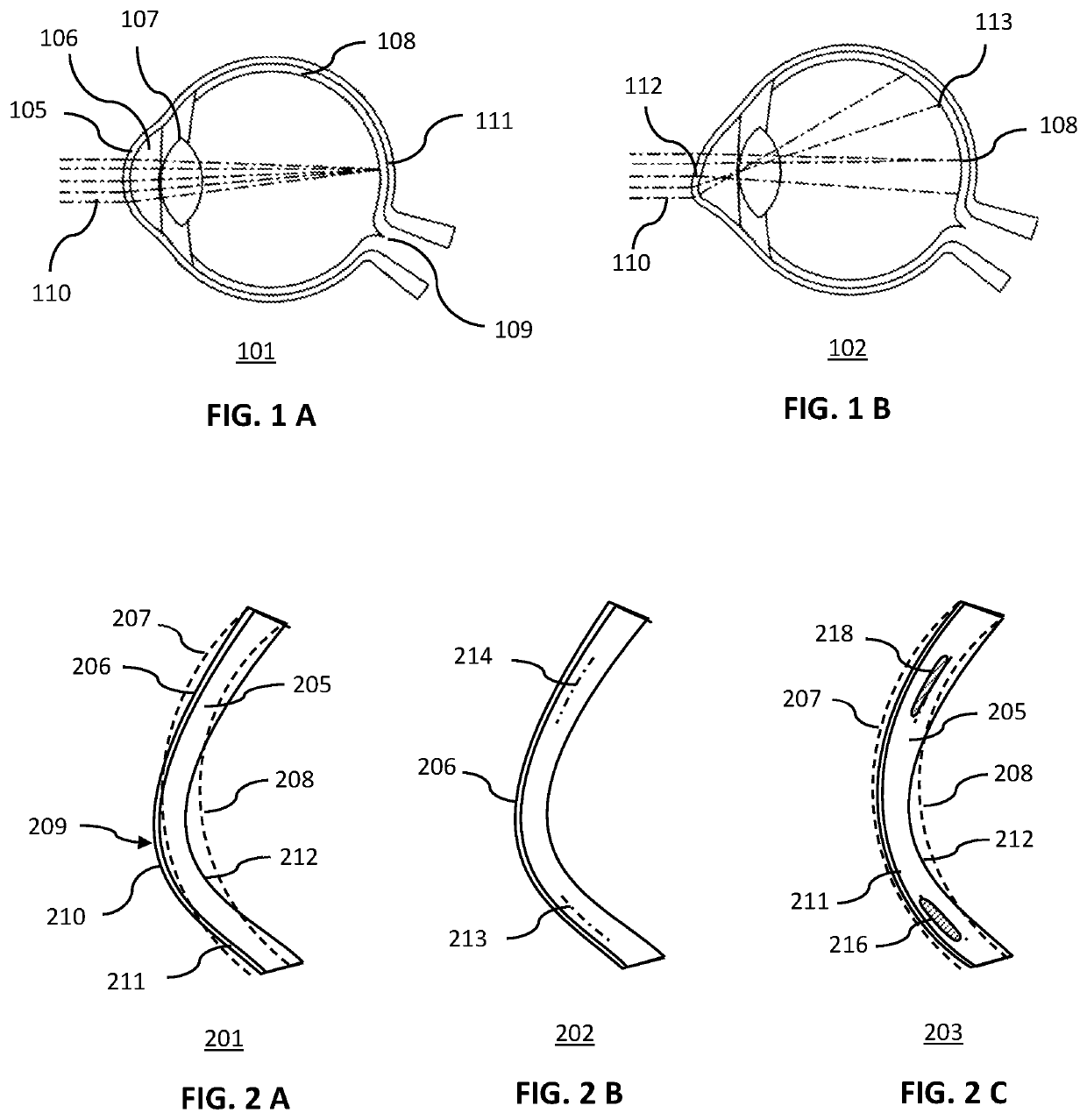 Method for the amelioration of ectatic and irregular corneal disorders