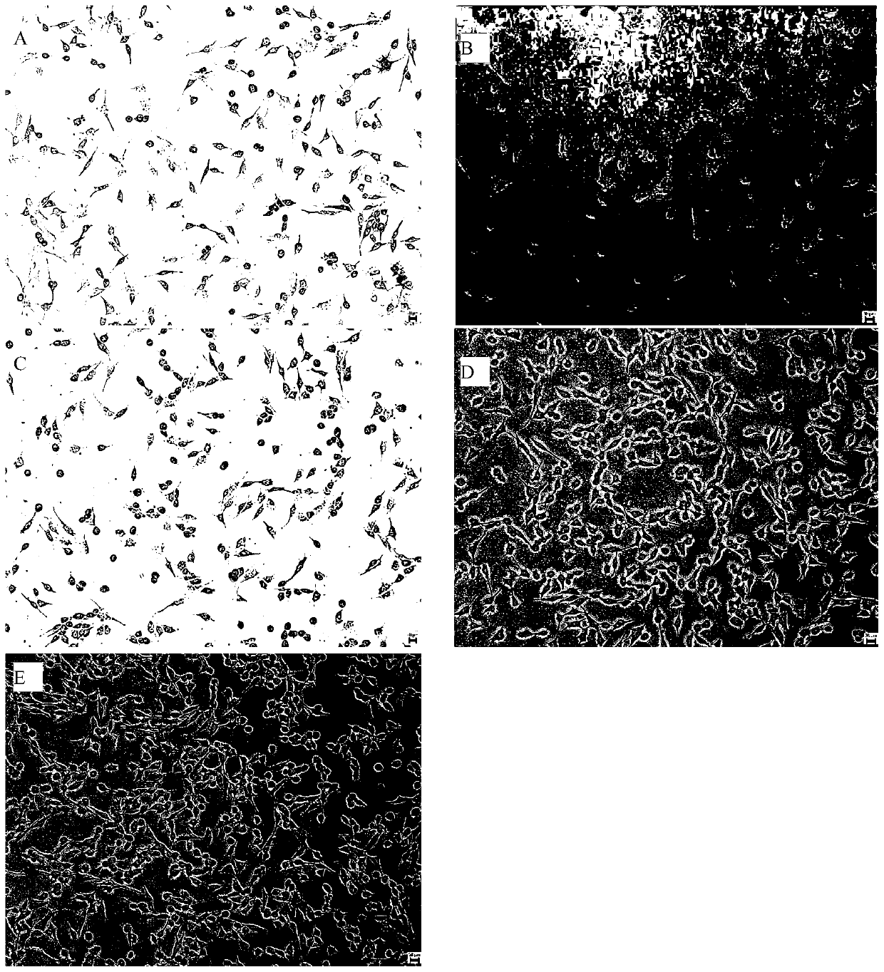 Neem-aloe extract for preventing and treating Propionibacterium acnes and its application