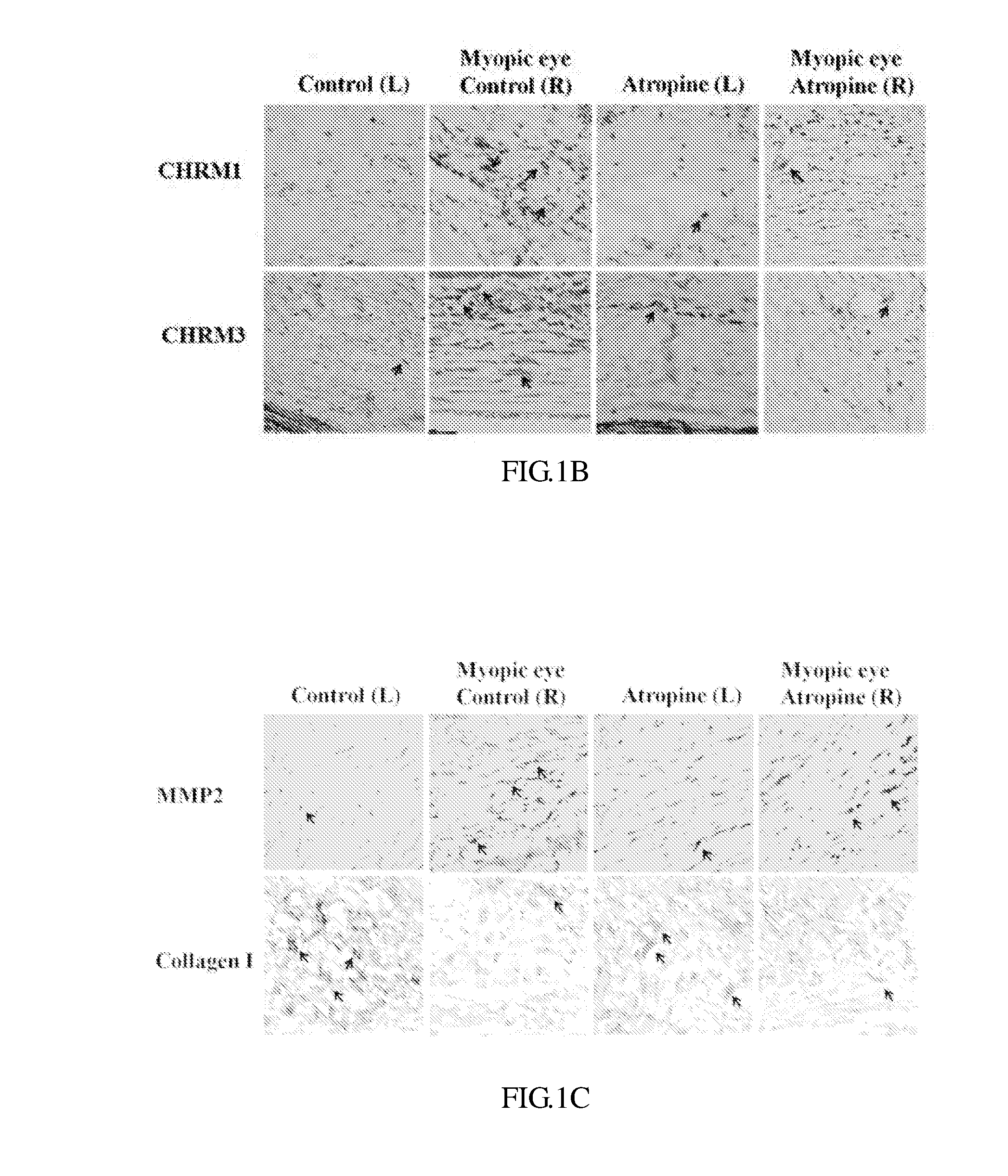 Composition and method for treating and relieving myopia