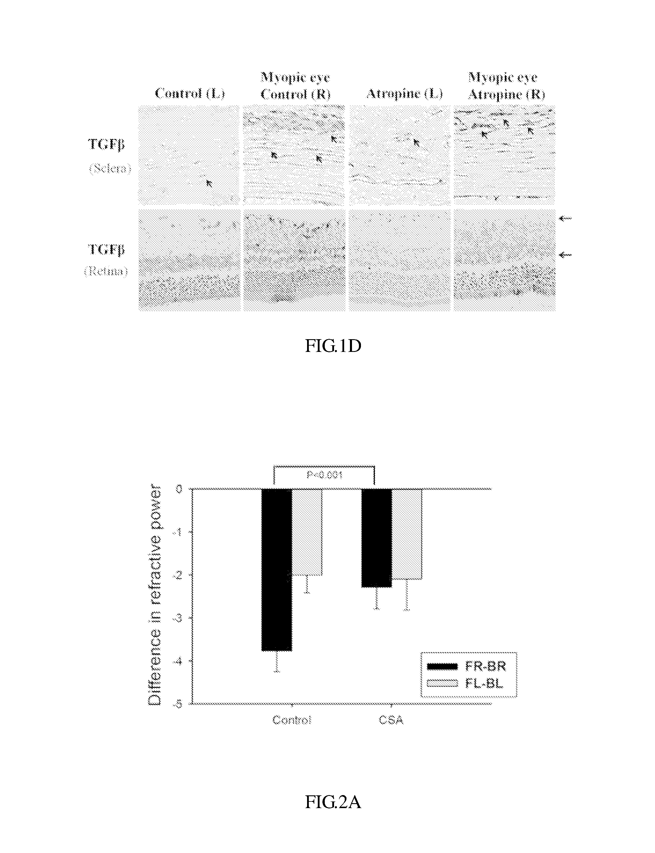 Composition and method for treating and relieving myopia