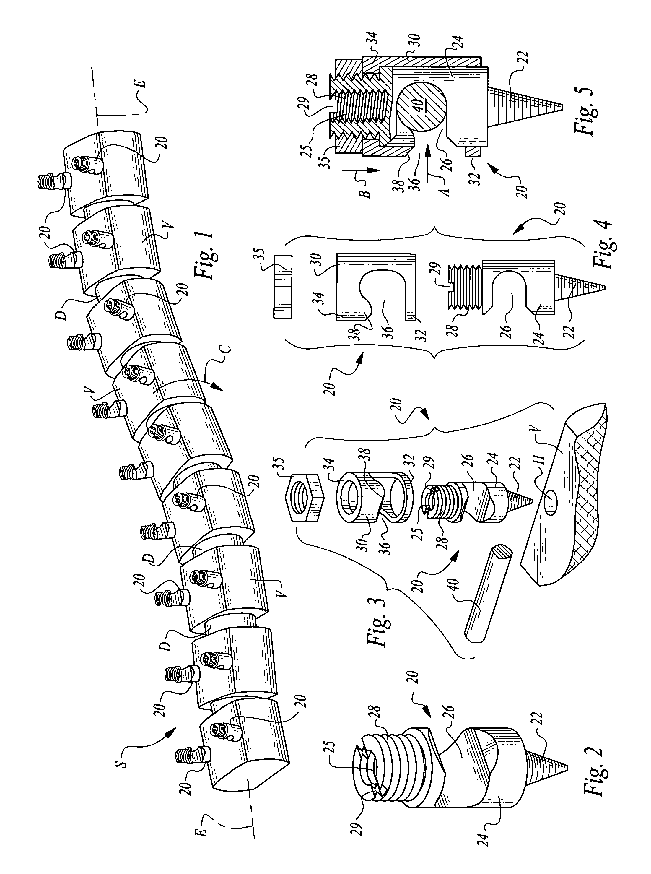 Scoliosis de-rotation system and method