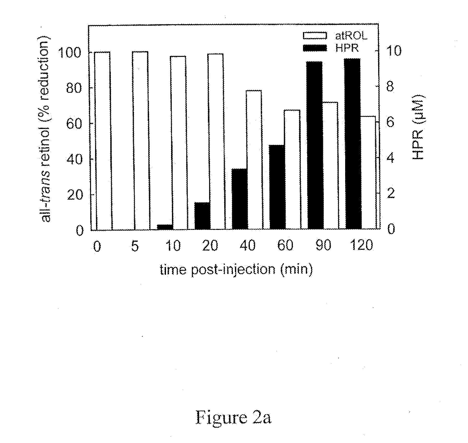 Methods and compositions for treating ophthalmic conditions with retinyl derivatives