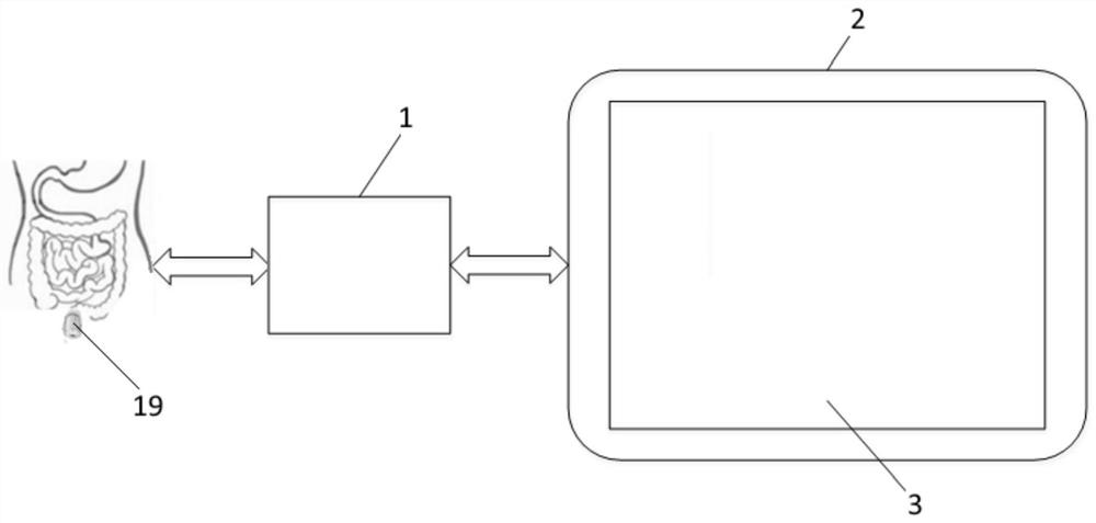 In-vitro control system of artificial anal sphincter device