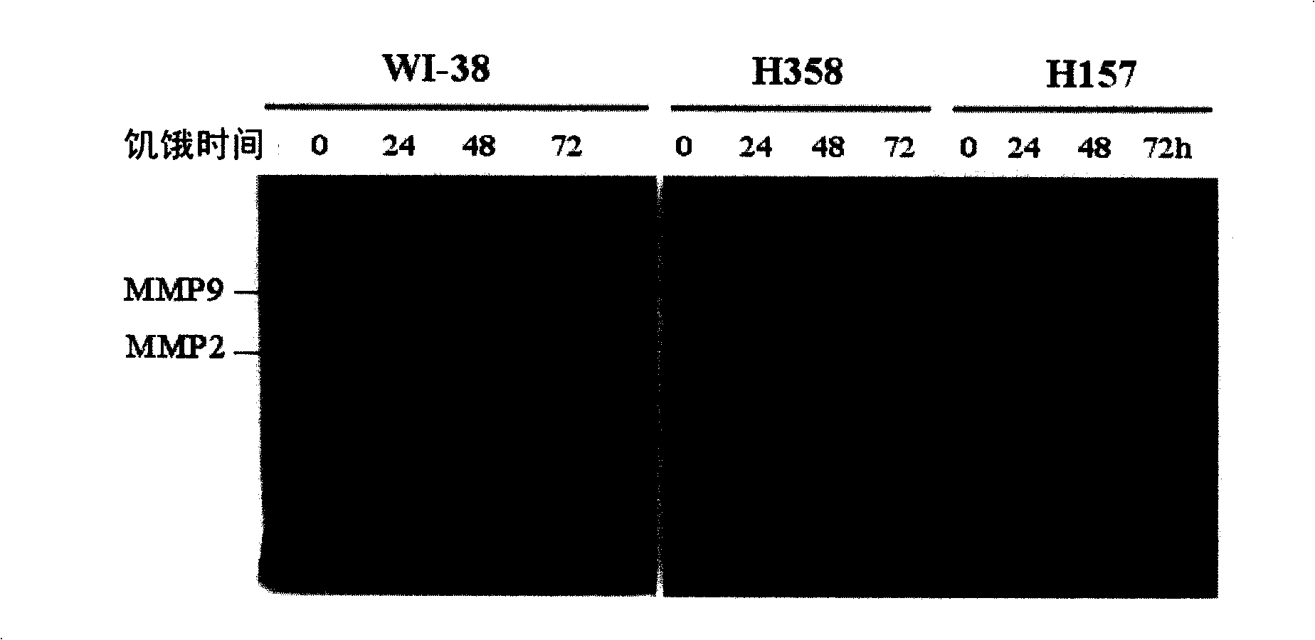 Novel use of ubiquitin c-terminal hydrolase-l1
