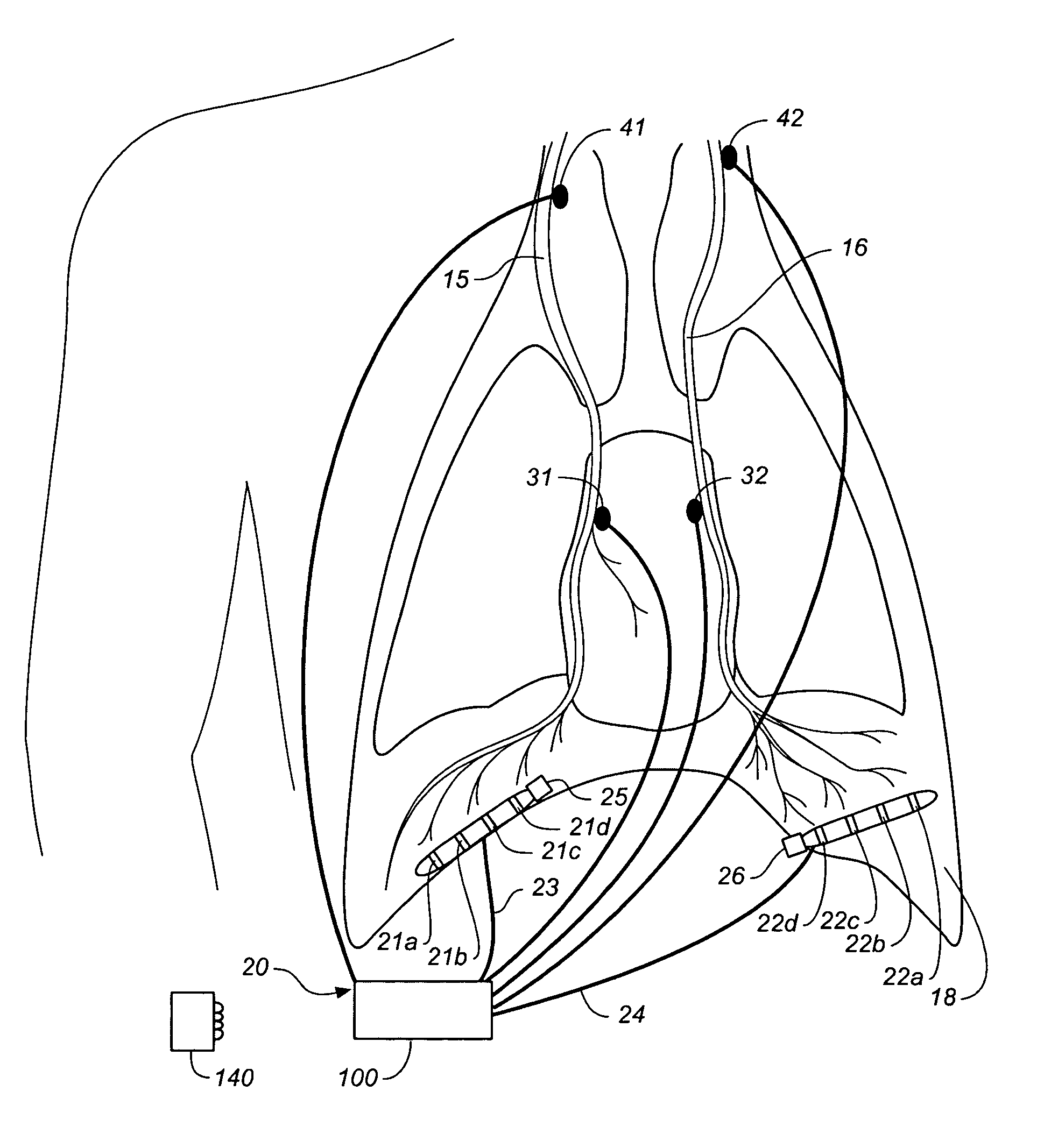 Device and method for gradually controlling breathing