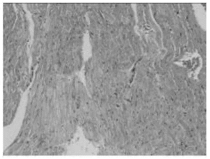 A traditional Chinese medicine composition for treating chronic heart failure and its preparation method and application