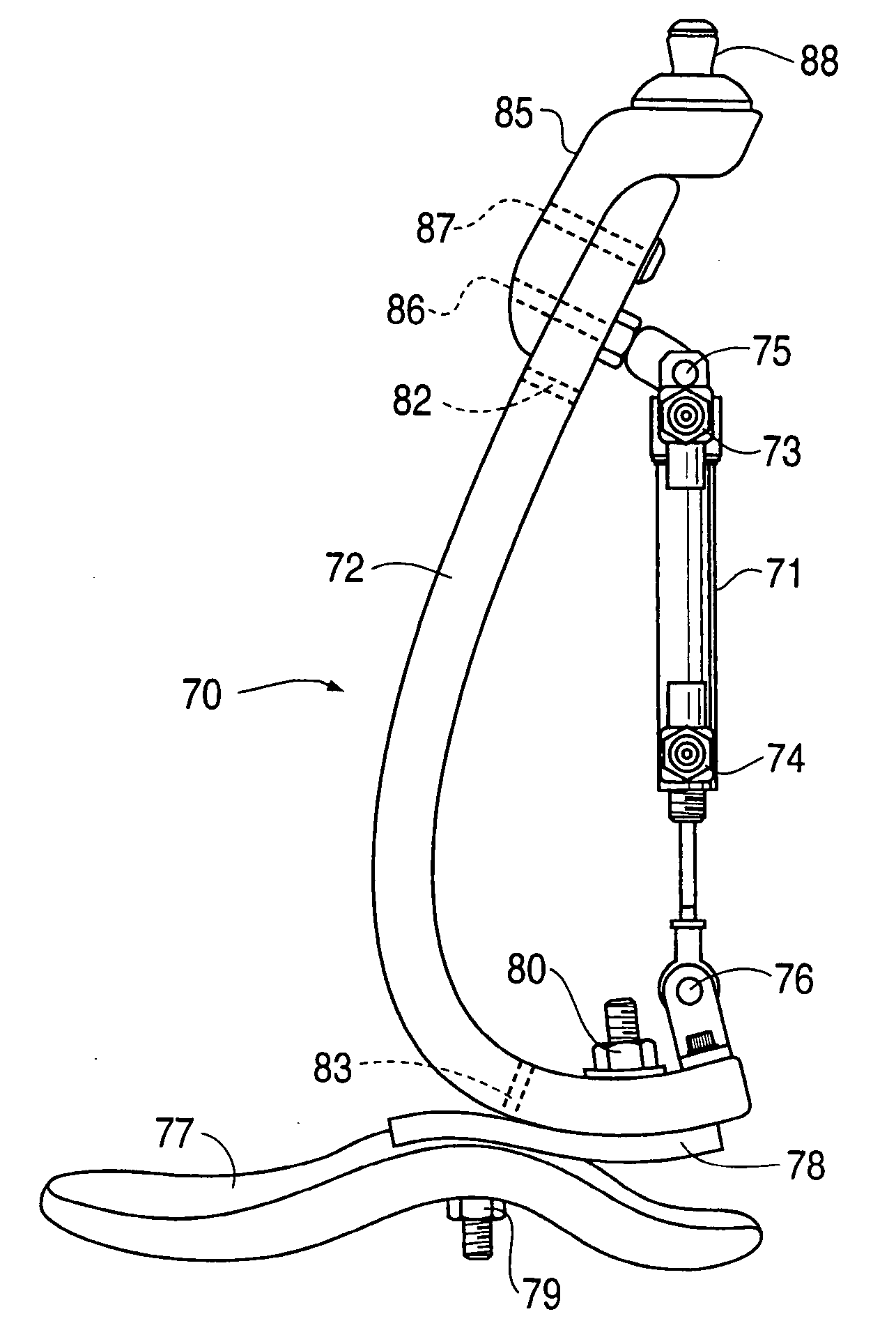 Prosthetic foot with tunable performance